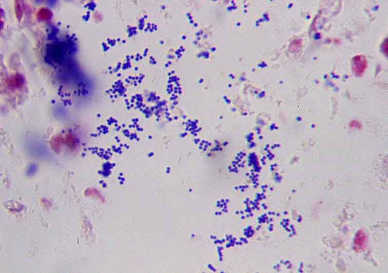 Staph Epidermidis Gram Stain