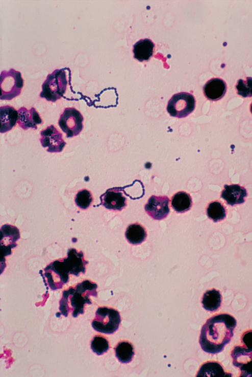 Streptococcus_viridans